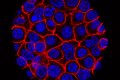 Experimental pill promises new hope for deadly pancreatic cancer