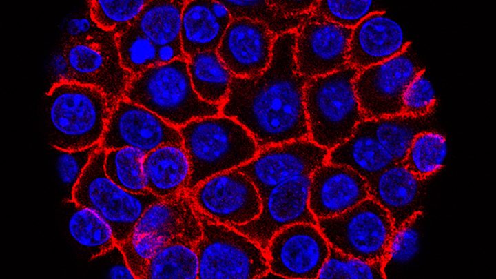 Experimental pill promises new hope for deadly pancreatic cancer