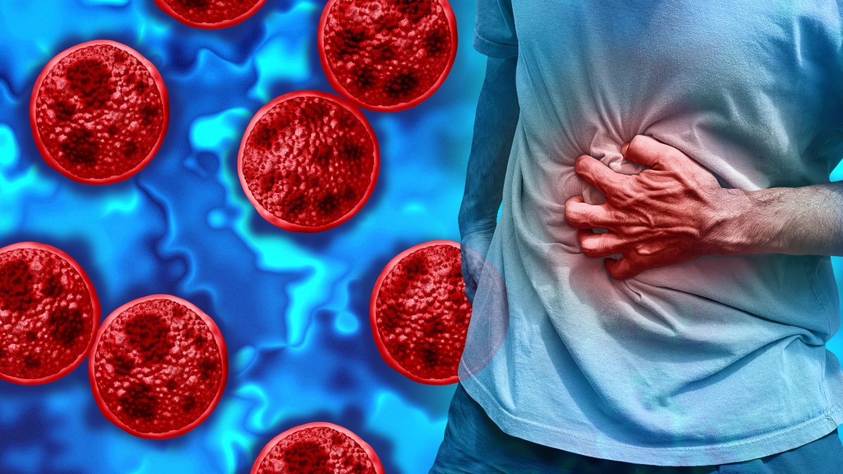Cyclosporiasis disease Outbreak